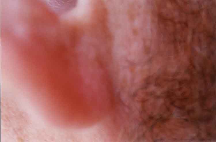 If picture is not shown here, it probably doesnot exist for this quality ... (choose another quality)